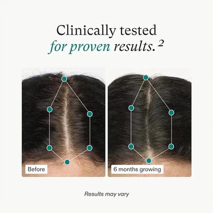 Nutrafol Women's Hair Growth Supplements